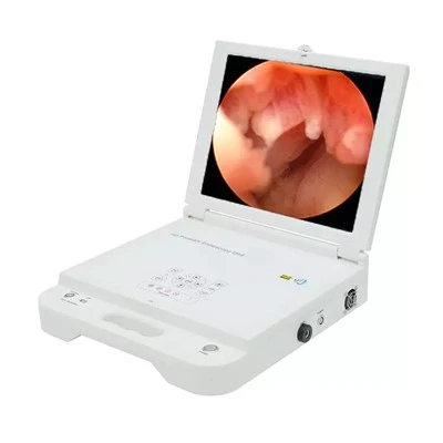 Camera Endosgop Offer Diagnosis Meddygol