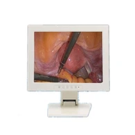 Monitor Camera Endosgop Modfedd Meddygol15-Medr